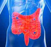 Simptomi sindroma razdražljivega črevesja (IBS)