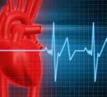 Sinusna tahikardija srca: zdravljenje, simptomi, vzroki, simptomi