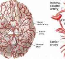 Vaskularne bolezni možganov
