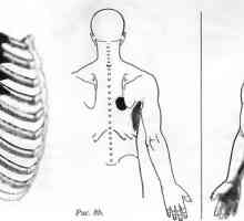 Bolečine v hrbtu, ki jih je serratus anterior mišice povzroča