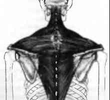 Bolečine v hrbtu, ki ga mišice trapezius povzroča