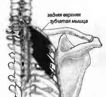 Bolečine v hrbtu, ki ga serratus povzroča