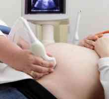 Nosečnost testi za dol. Krvni test za Downov sindrom v času nosečnosti
