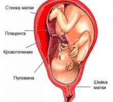 Krvavitev v prvem trimesečju nosečnosti. Zakaj se zdi, in ali je to normalno?