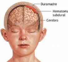 Subduralna možgani hematom: posledice zdravljenja