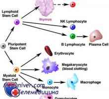 Transplantaciji izvornih celic in Hodgkinovega limfoma (Hodgkinova bolezen)