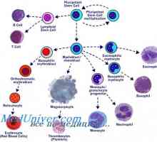 Presaditev matičnih celic v mieloproliferativne bolezni mieloleykoze