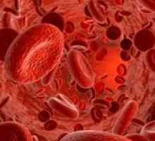 Trombocitopenija: Zdravljenje, vzroki, simptomi, znaki