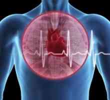 Pljučna embolija in akutnega srčnega popuščanja