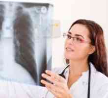 Pljučna tuberkuloza med nosečnostjo, zdravljenje, simptomi, vzroki