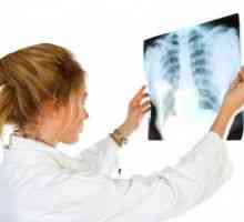 Tuberkuloza perifernih bezgavk