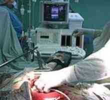 Kirurgija odstranitev tumorja za raka trebušne slinavke