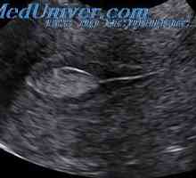 UZI jajcevodih. Transvaginalnih ultrazvok okrogle vezi in črevesje