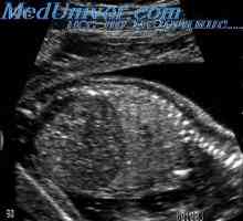 Fetalnih pankreasa UZI. Pregled žolčnika zarodka