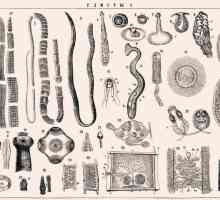 Vrste črvi v človeškem telesu, glavne sorte črvi (okužbe helminti, paraziti)
