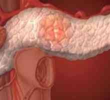 Maščobno pankreasa (nekroza trebušne slinavke)