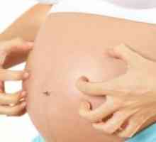 Srbeča koža med nosečnostjo v zgodnjih in kasnejših fazah: vzroki, zdravljenje