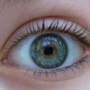 Acanthamoeba keratitis oči: zdravljenje, simptomi, diagnosticiranje