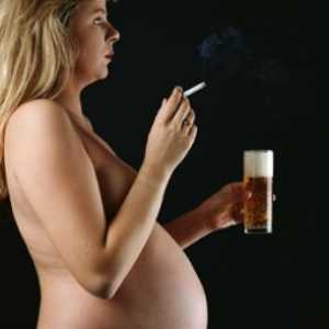 Sindrom Fetalni alkohol