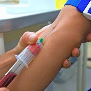 Krvni test za protitelesa proti helminti antigenov helminti