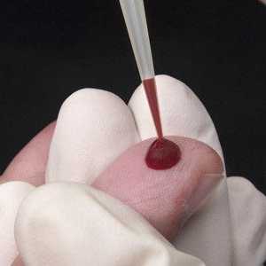 Analiza krvi glist (enterobiasis)