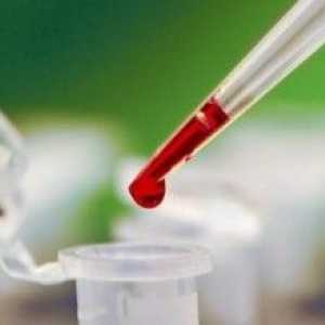 Analiza krvi raka trebušne slinavke