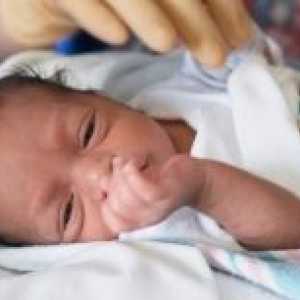 Anemija pri novorojenčkih: vzroki, zdravljenje, obseg, posledice, simptomi, znaki