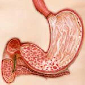 Antruma zdravljenje gastritis in prehrana