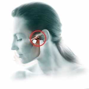 Artritis od temporomandibularnega sklepa: zdravljenje, simptomi, diagnostika