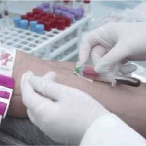 Biokemijska analiza krvi