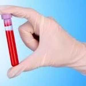 Biokemijske preiskave krvi, trebušne slinavke s pankreatitisom