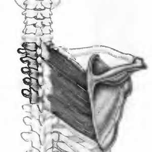 Bolečine v hrbtu, ki so jih romboidnih mišic povzroča
