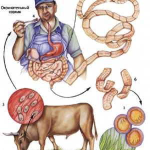 Govedo (neoborožen) trakulje govedina okužba trakulja pri človeku