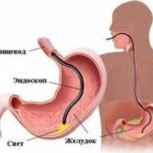 Diagnoza gastroduodenita