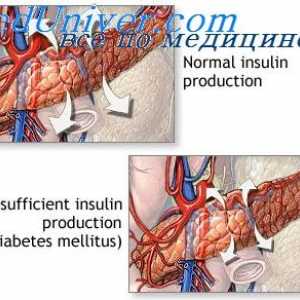 Učinek insulina na presnovo ogljikovih hidratov. Izmenjava glukoze inzulin