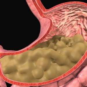 Fibrinous gastritis