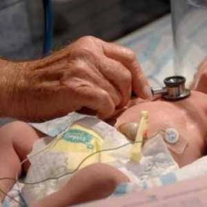 Hemolitični bolezni novorojenčka, zdravljenje, vzroki