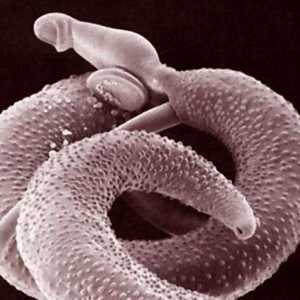 Worms (helminti) olajševalno imunost