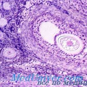 Gormonalnoaktivnye ovarijski tumorji. Follikuloma