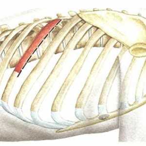 Kirurški pristopi k prsni hrbtenici