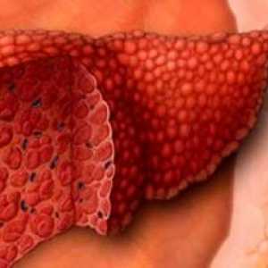 Karcinom jeter: prognoza, zdravljenje