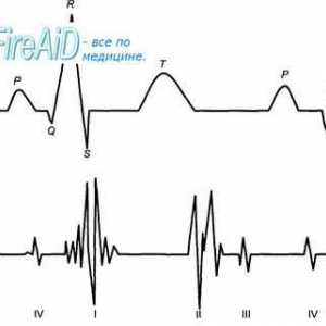 Srce se sliši. Prvi (sistolični) srce zvok. Drugi (diastolični) srce zvok. Phonocardiogram.