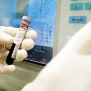 Analiza krvi. krvni test