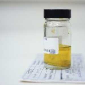 Analiza urina, analiza urina