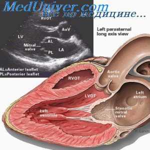 Hemodinamičnih motenj pri poškodbah srcem in telesnega napora