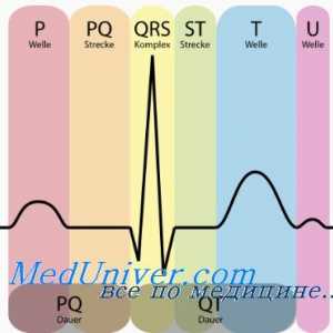 Trije standardni EKG vodi. Prsni koš svinca elektrokardiogram