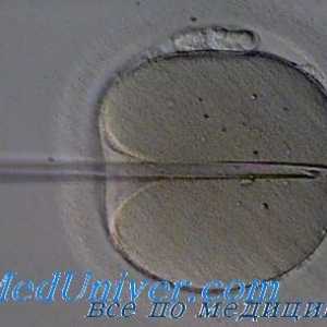 In vitro oploditvijo (IVF). Priložnosti in možnosti