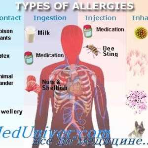 Epidemiologijo (razširjenost) alergijskih bolezni atopije