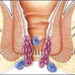 Ezofagitis in kožni gastropatije