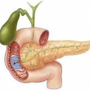 Erozivni in ulcerozni duodenitis